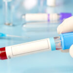 close up hand of a medical professional holding a blood test tube with empty mock up label on blue background, copy space