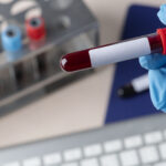 Surgeon holding a blood test